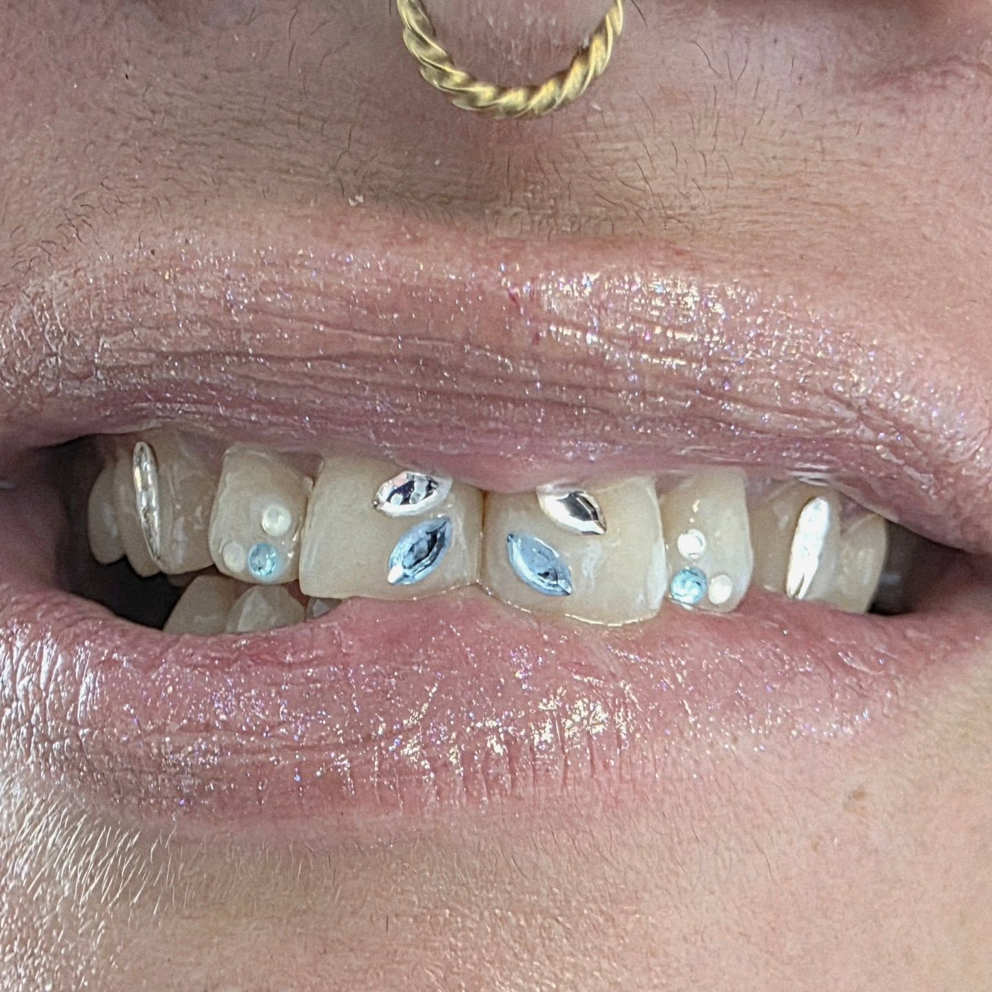 Bijoux dentaires